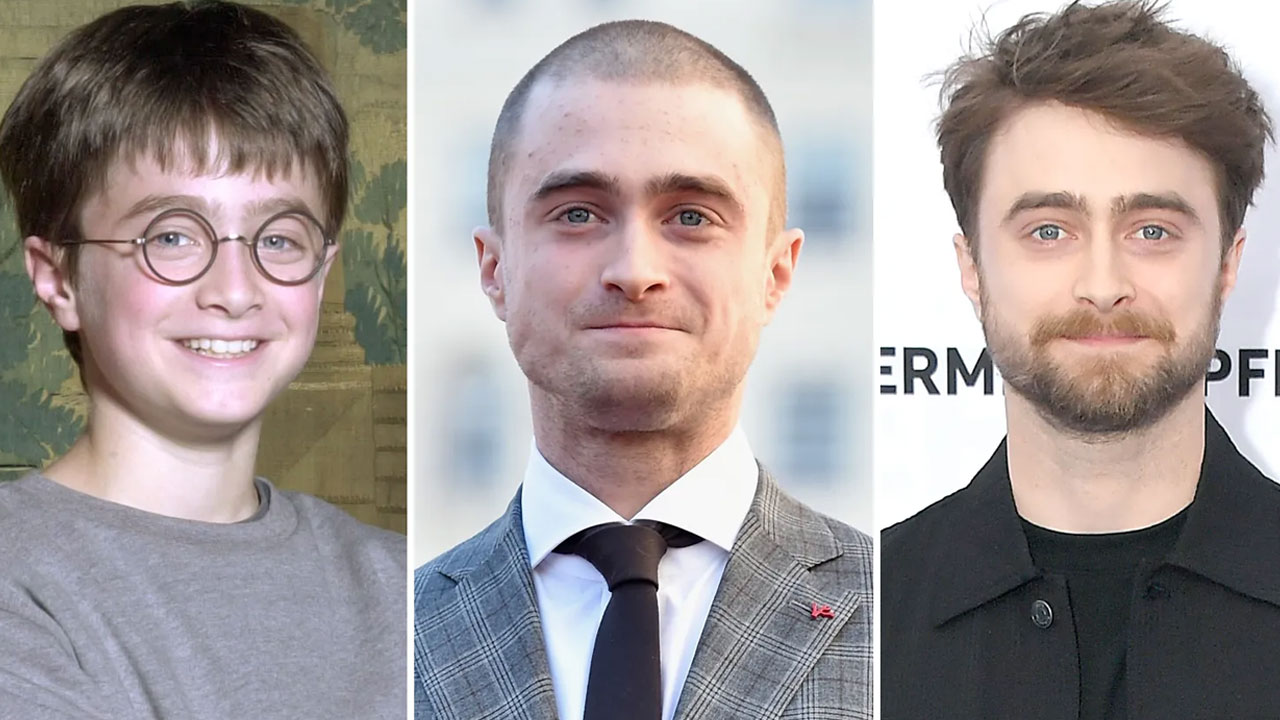 The Metamorphosis of Daniel Radcliffe: From Harry Potter to Hollywood’s Most Unique Star